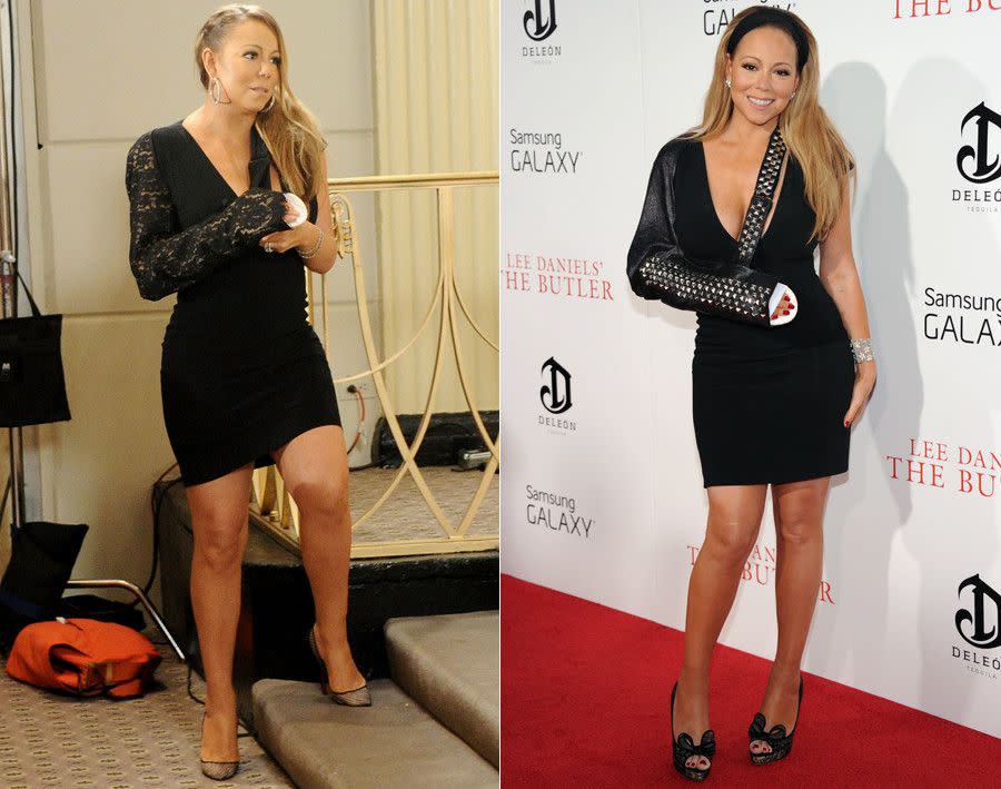 Mariah Carey is trying to start a new trend -- fashionable arm slings. Not one to let something so trivial as a dislocated shoulder slow her down, the singer donned not one, but TWO different blinged out slings while making the red carpet rounds to promote her new movie "The Butler" in New York City on Aug. 5, 2013. The diva wore a black lace sleeve that seamlessly matched her dress while attending a press conference at the Waldorf Astoria Hotel (l.) before changing into a different studded leather look for the movie's red carpet premiere later in the day. Carey suffered a dislocated shoulder on the set of her new music video in July 2013 and has since taken a few creative liberties when it comes to dressing up her sling.