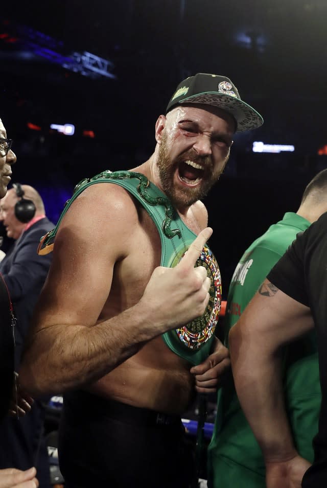 Tyson Fury features on the album (Isaac Brekken/AP)