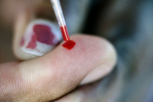 A person takes a blood test at a roadside AIDS testing stand in Langa, Cape Town, during International AIDS Day in 2010. An international group of scientists have called for all adults who test positive for HIV to be treated with antiretroviral drugs immediately