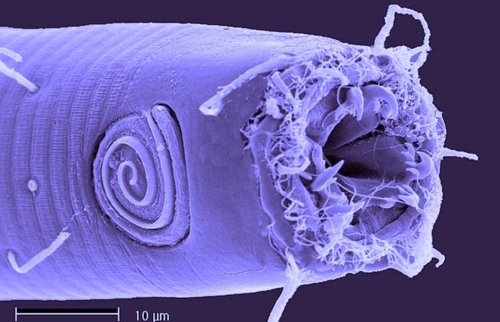 Imagen microscópica de un nematodo odontophora.