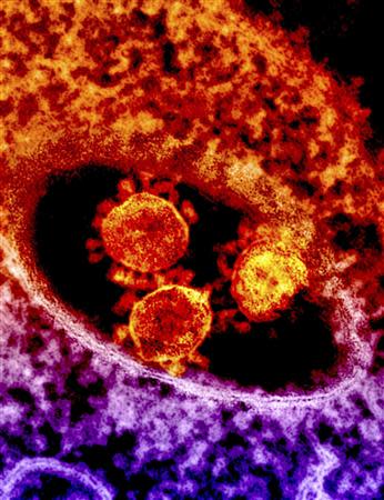 Particles of the Middle East respiratory syndrome (MERS) coronavirus that emerged in 2012 are seen in an undated colorized transmission electron micrograph from the National Institute for Allergy and Infectious Diseases (NIAID). REUTERS/National Institute for Allergy and Infectious Diseases/Handout via Reuters