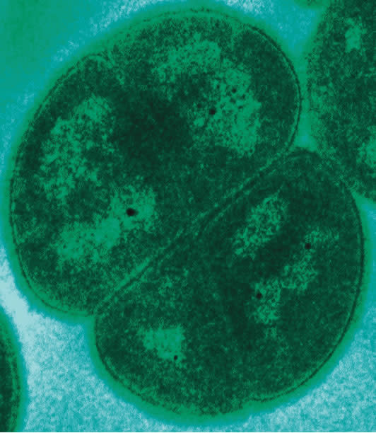 Deinococcus radiodurans seen under an electron microscope. Image credit: Oak Ridge National Laboratory.