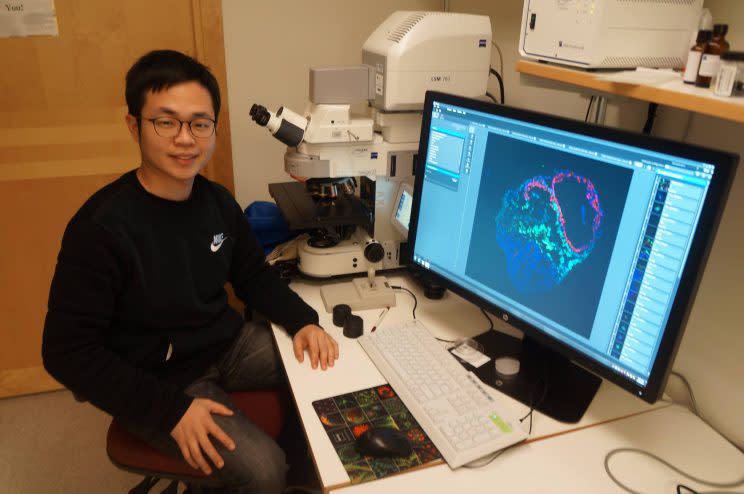 Sunny以一級榮譽畢業於中大細胞及分子生物學， 畢業後遠赴瑞典攻讀博