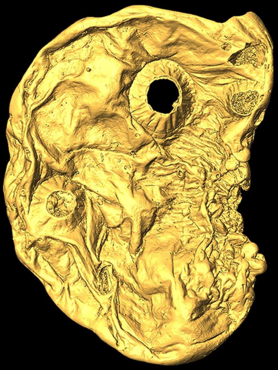 Una imagen muy detallada al microscopio del Saccorhytus coronarius.