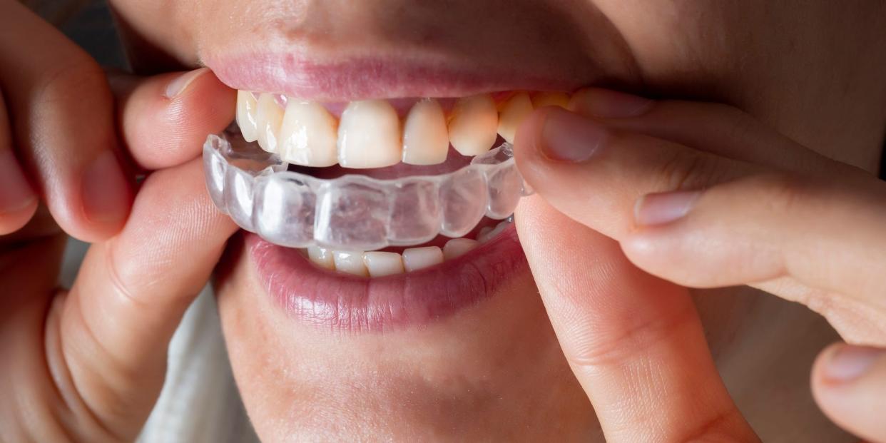 retainer Invisalign braces