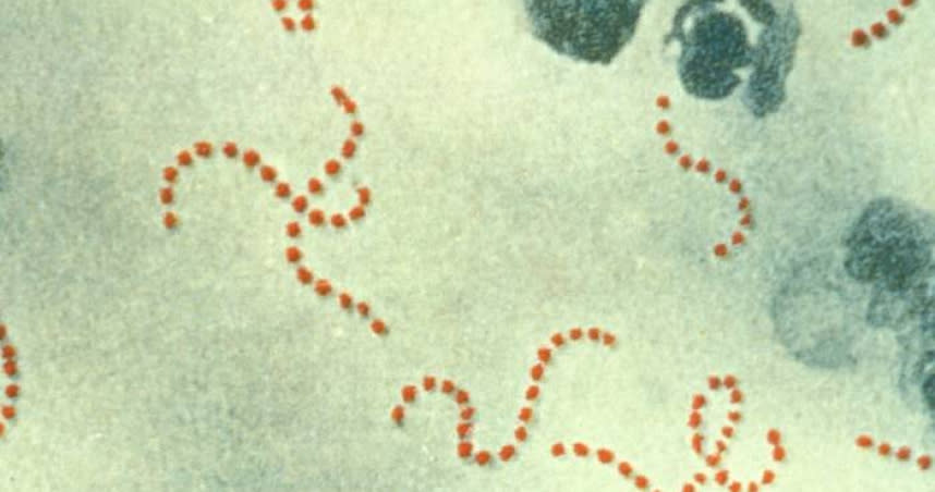 A型溶血性鏈球菌。（圖／翻攝自維基百科）
