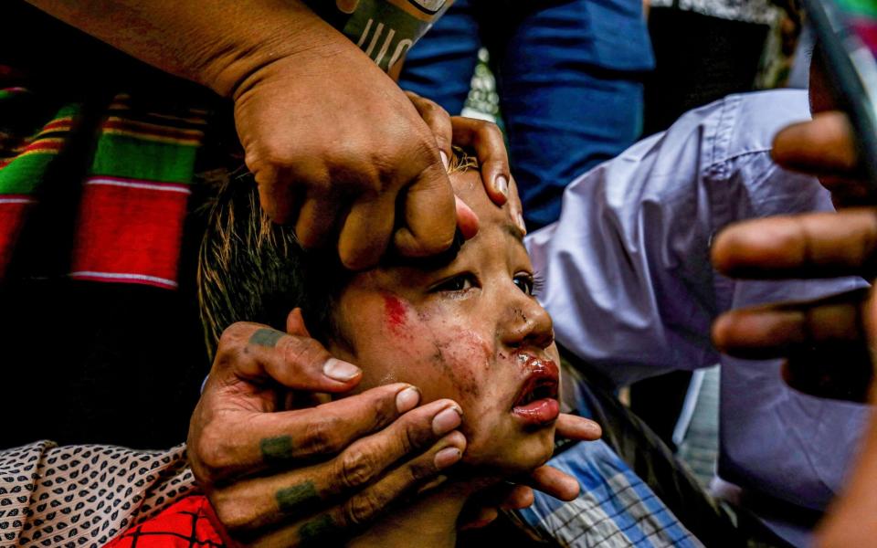 A bruised child being slingshot by soldiers hiding his their truck during an anti-coup demonstration