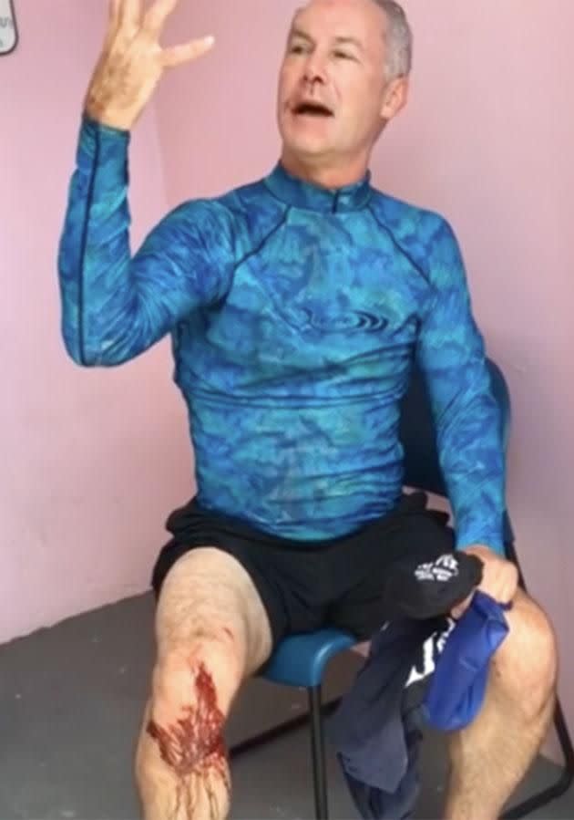 Luckily Cutbirth came out of the incident with superficial cuts. Photo: YouTube