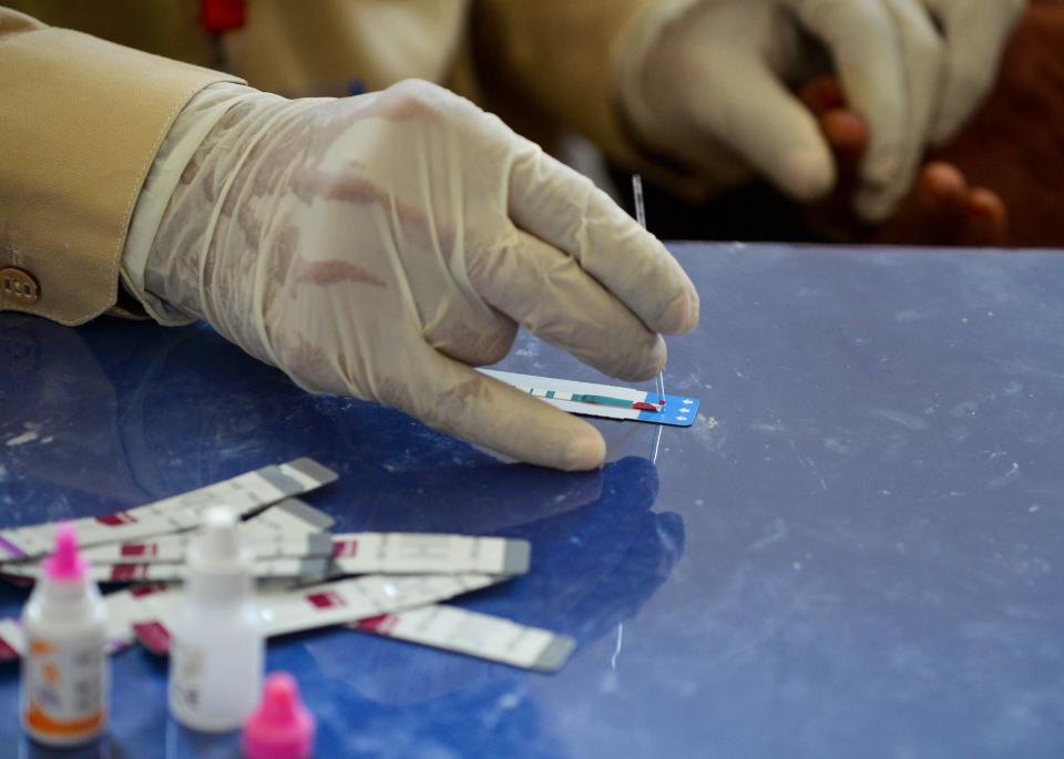 <p>A doctor examines a blood sample taken from a woman during an HIV test</p> (AFP/Getty)