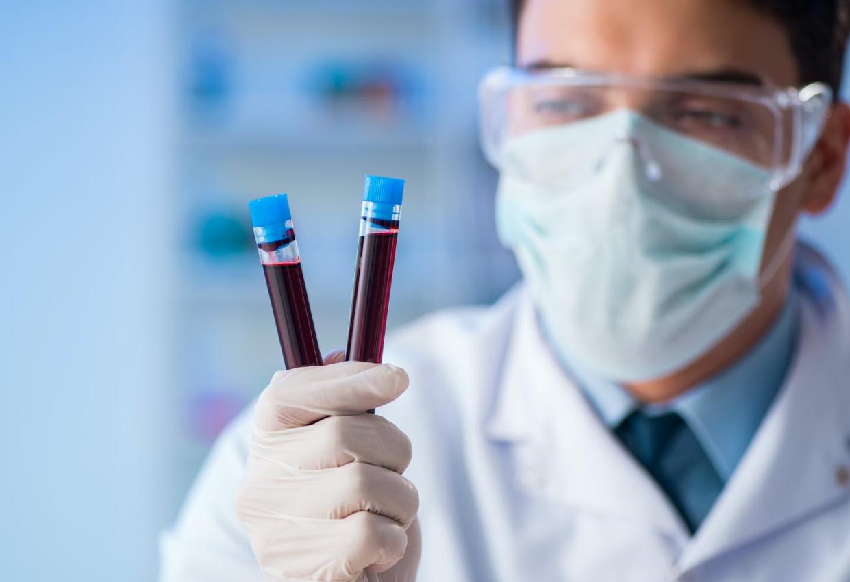 Is it always the same? <a href="https://www.shutterstock.com/image-photo/lab-assistant-testing-blood-samples-hospital-1099719305" rel="nofollow noopener" target="_blank" data-ylk="slk:Elnur/Shutterstock.com;elm:context_link;itc:0;sec:content-canvas" class="link ">Elnur/Shutterstock.com</a>