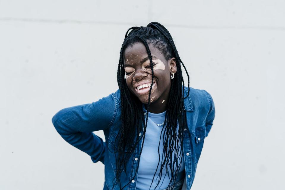 Portrait of a smiling African American woman with vitiligo