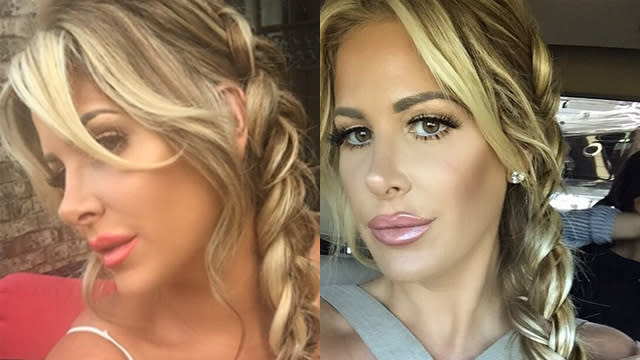 Kim Zolciak Insists Shes Never Had Plastic Surgery On Her Face