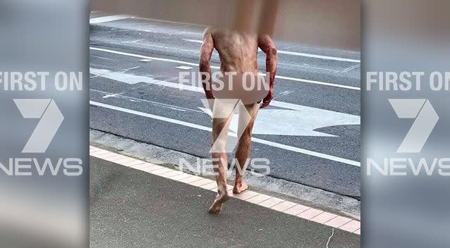 A patron at the Boundary Hotel in Bentleigh East witnessed the man exiting a car at about 8pm on Sunday. Photo: Supplied