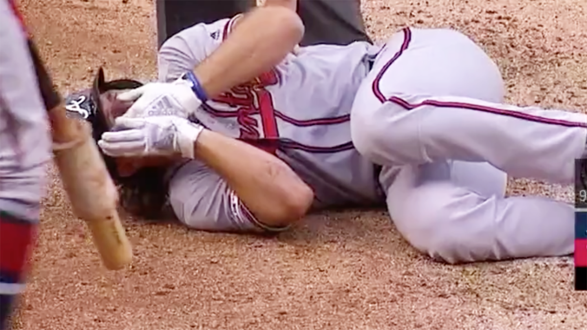 Charlie Culberson gets hit in the face by a pitch 
