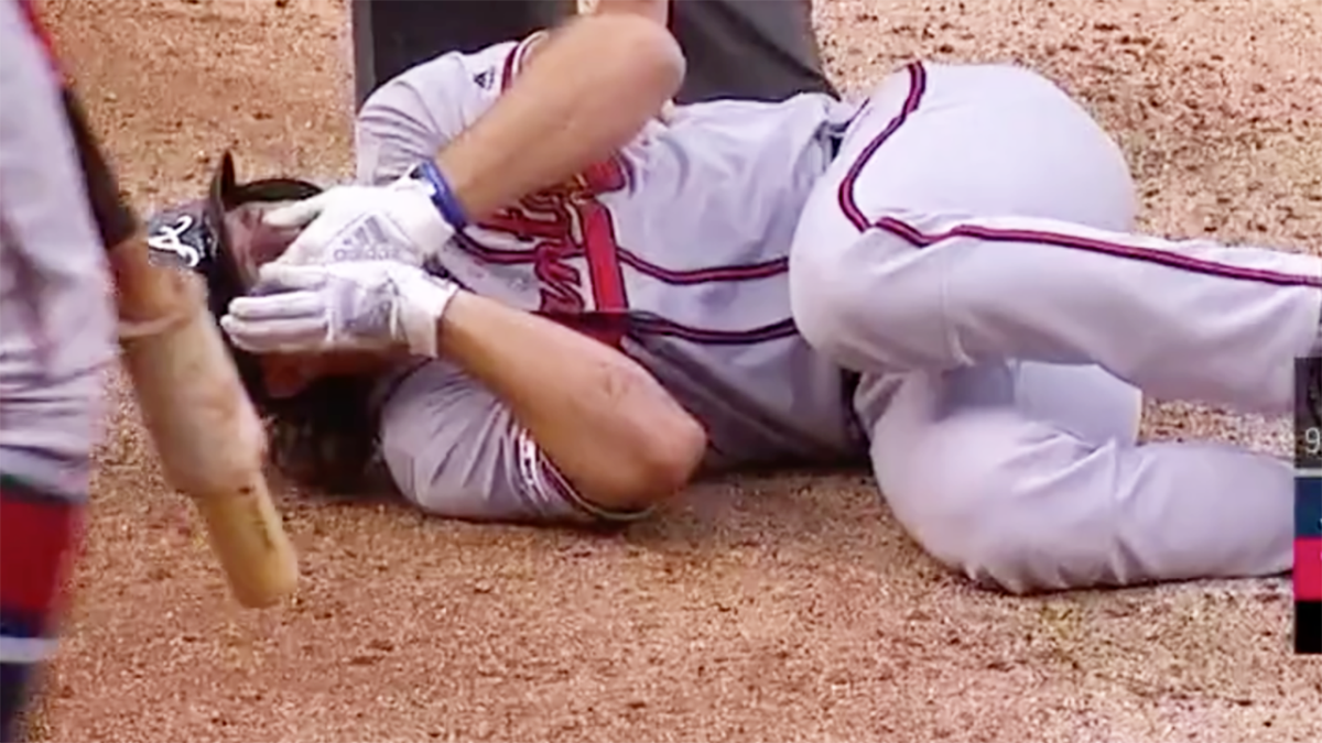 Braves Charlie Culberson Getting Hit in the Face 