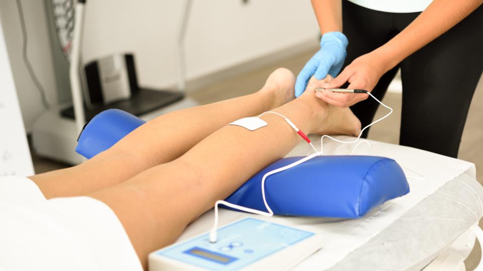 Electroacupuncture dry with needle on female ankle
