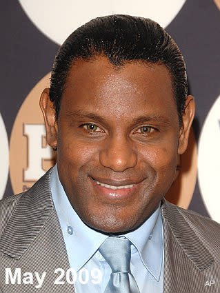 Sammy Sosa Bleaches Skin