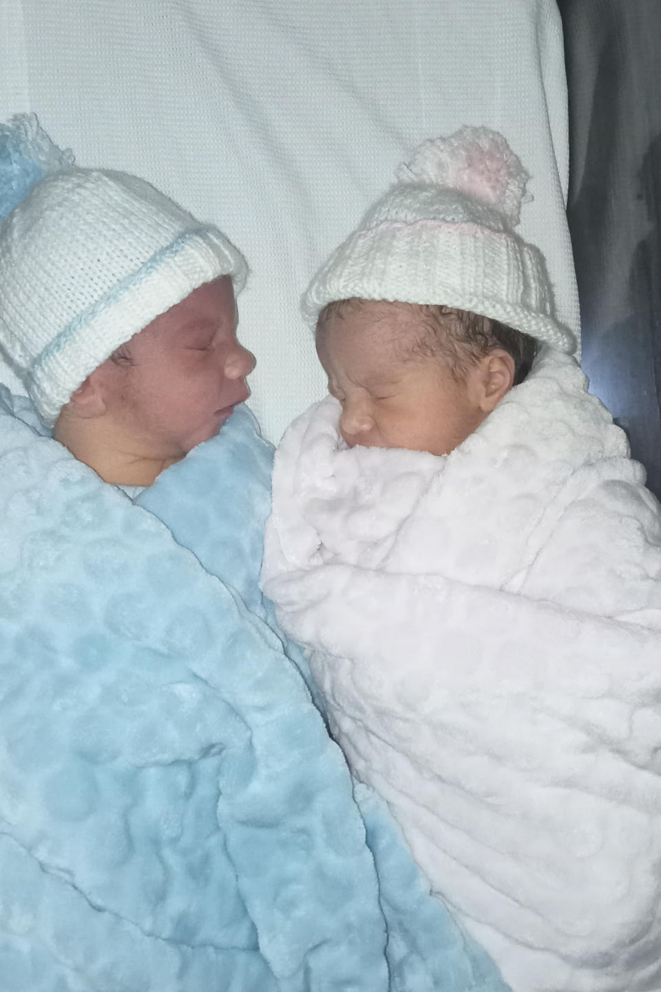 The twins' unusual birth was a first for the hospital. (Diane McLaren/SWNS)