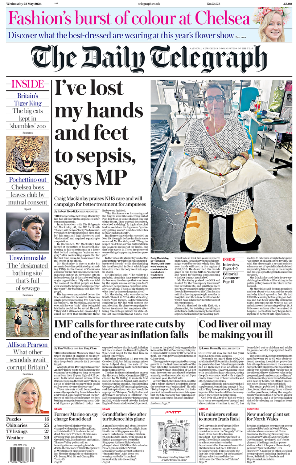 "I've lost my hands and feet to sepsis, says MP" is the headline on the Telegraph