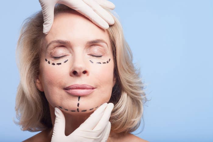 A doctor inspects a female patient's face, which has been drawn on in preparation for a cosmetic surgery