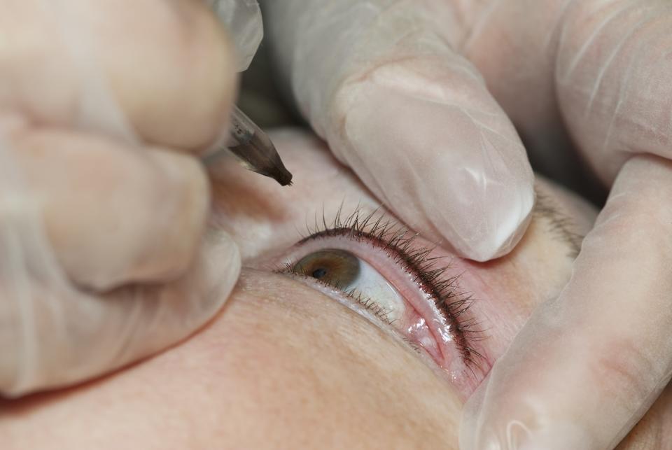 <h1 class="title">Close up of permanent makeup procedure on eye</h1><cite class="credit">Getty Images</cite>