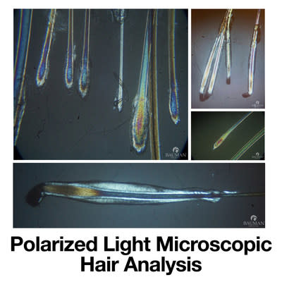 Polarized Light Microscopy is a diagnostic technique that allows Trichologists and Hair Restoration Physicians to diagnose specific hair and scalp problems and conditions in order to recommend targeted treatment choices for patients.