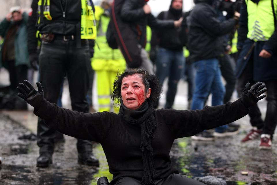 An injured woman sits on the ground as police officers intervene with tear gas during a protest against rising fuel taxes near Arc de Triomphe in Paris on Dec. 1, 2018. (Photo: Elyxandro Cegarra/Anadolu Agency/Getty Images)