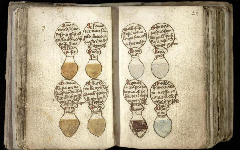 Drawings of urine flasks, illustrating the different colours of a patient's urine, with their ailments described in roundels above - Master and Fellows of Trinity College/Cambridge /PA