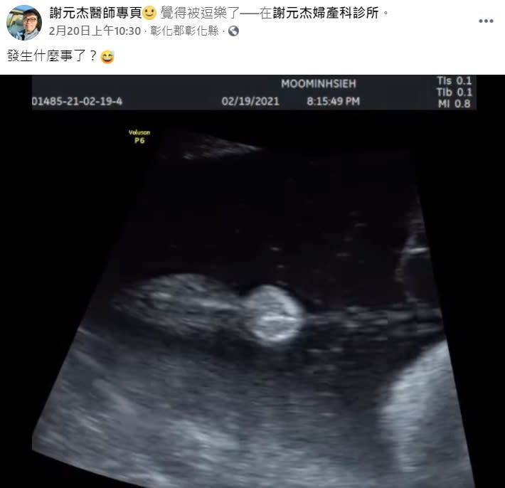 謝元杰醫師在臉書PO出超音波畫面。（圖／翻攝自謝元杰醫師專頁 臉書）