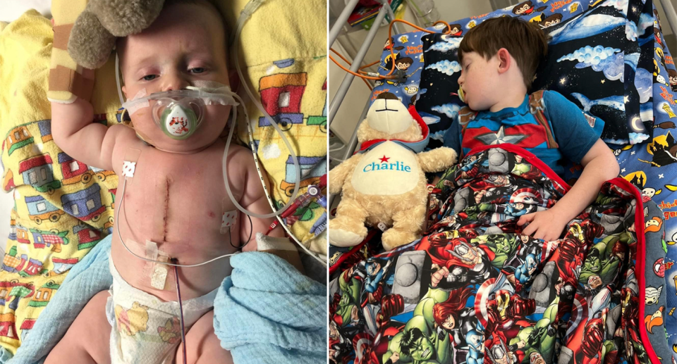 Canberra boy Charlie has faced a lifetime of medical treatments.