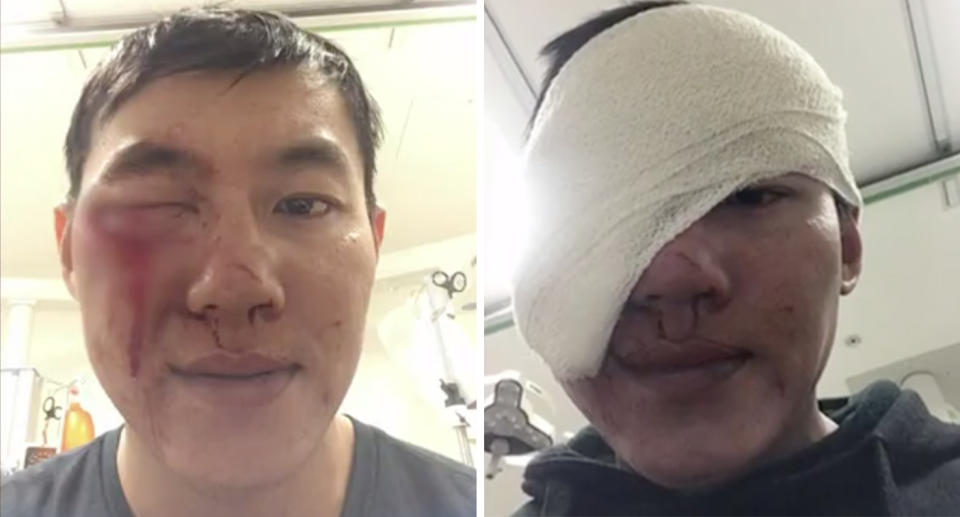 Uber Eats driver Ivan Jonatahir was bashed by a teenage gang in an unprovoked attack while delivering food in Perth. Source: 7 News