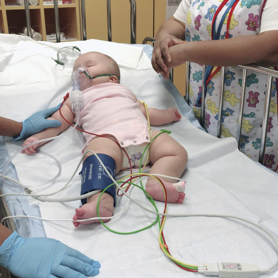 This photo provided by Judy Wei shows her daughter, Rylae-Ann Poulin, the first time she was admitted to an ICU, at a Singapore hospital in September 2018. When Rylae-Ann Poulin was a year old, she didn’t crawl or babble like other kids her age. A rare genetic disorder kept her from even lifting her head. Her parents took turns holding her upright at night just so she could breathe comfortably and sleep. (Judy Wei via AP)