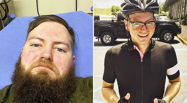 After being hospitalised for excessive alcohol consumption (left), this man turned his life around and became a happier and healthier version if himself just six months later. Picture: Reddit