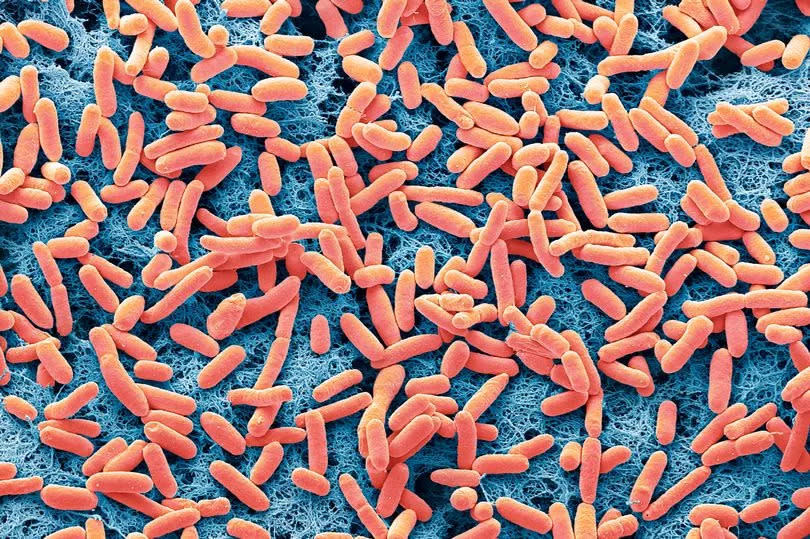 E.coli bacteria. A person has died and 30 are ill after an outbreak of food poisoning linked to cheese