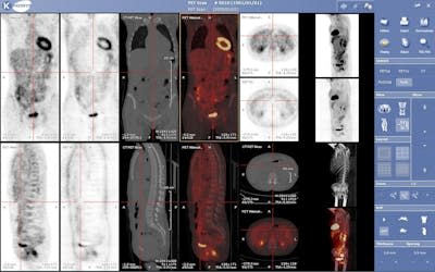 El deep learning puede ayudar a los médicos en el diagnóstico por imagen, aunque para el profesional es difícil saber qué ha llevado al algoritmo a dar con un veredicto médico u otro. <a href="https://commons.wikimedia.org/wiki/File:Viewer_medecine_nucleaire_keosys.JPG" rel="nofollow noopener" target="_blank" data-ylk="slk:Mco44 / Wikimedia Commons;elm:context_link;itc:0;sec:content-canvas" class="link ">Mco44 / Wikimedia Commons</a>, <a href="http://creativecommons.org/licenses/by/4.0/" rel="nofollow noopener" target="_blank" data-ylk="slk:CC BY;elm:context_link;itc:0;sec:content-canvas" class="link ">CC BY</a>