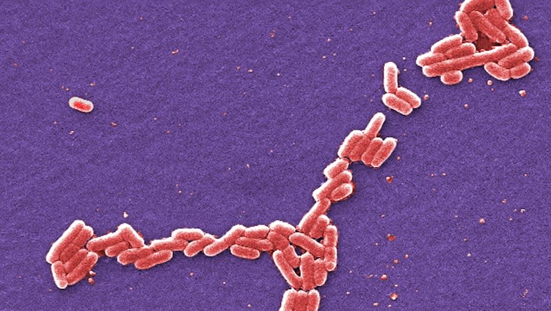 This colorized 2006 scanning electron microscope image made available by the Centers for Disease Control and Prevention shows E. coli bacteria of the O157:H7 strain that produces a powerful toxin which can cause illness. At least a dozen people in California and Washington have been sickened with E. coli food poisoning linked to organic walnuts sold in bulk in 19 states, U.S. health officials said Tuesday, April 30, 2024. Stores included chains such as Whole Foods and Market of Choice.