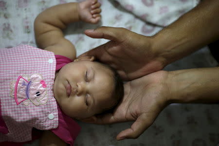 Felipe holds the head of his daughter Maria Geovana, who has microcephaly, at his house in Recife, Brazil, January 25, 2016. REUTERS/Ueslei Marcelino