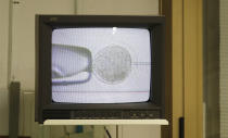 FILE - In this Sunday, Aug. 25, 2019 file photo, a monitor displays the inseminating of eggs from the last two remaining female northern white rhinos with frozen sperm from two rhino bulls of the same species, at the Avantea laboratory in Cremona, Italy. Groundbreaking work to keep alive the nearly extinct northern white rhino - population, two - by in-vitro fertilization has been hampered by travel restrictions caused by the new coronavirus. (AP Photo/Antonio Calanni, File)