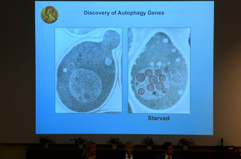Images to illustrate the work of Yoshinori Ohsumi are displayed during a press conference at the Nobel Forum in Stockholm, on October 3, 2016