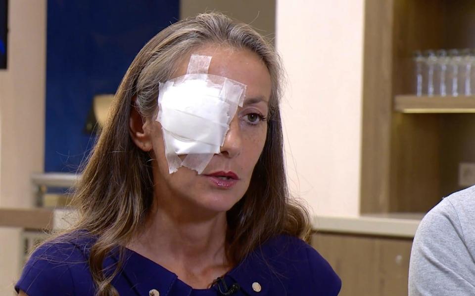 Corine Remande has been blinded in her right eye after incident at Ryder Cup - Universal News (Europe)