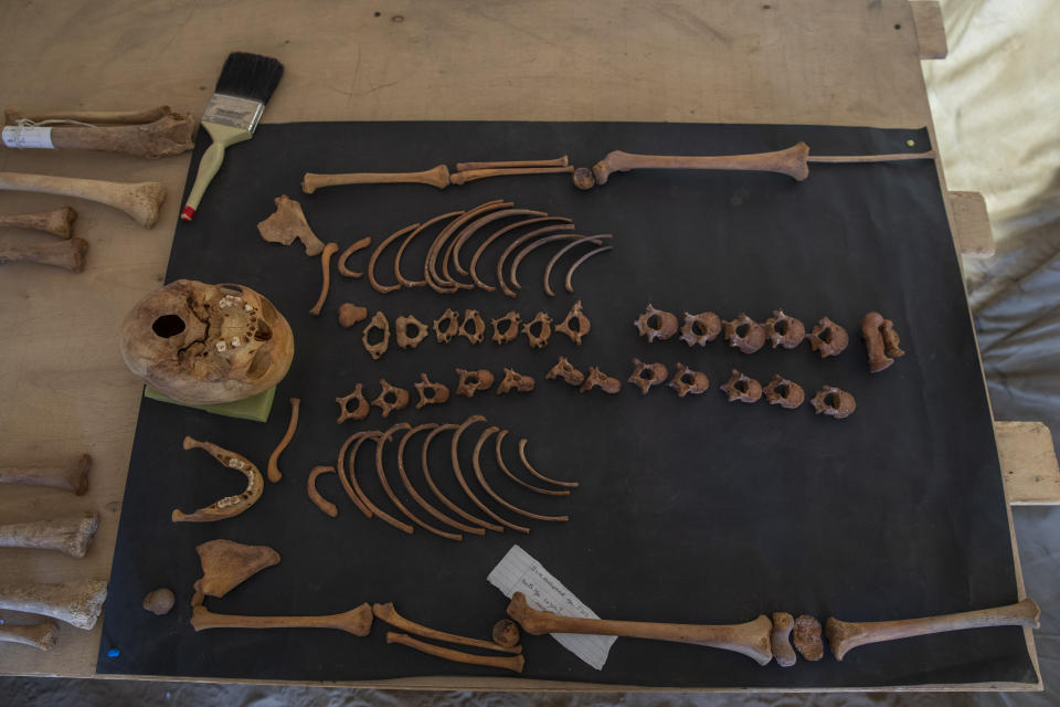 Ancient skull and bones are on display that Egyptian archaeologist Zahi Hawass and his team unearthed in a vast necropolis filled with burial shafts, coffins and mummies dating back to the New Kingdom 3000 BC, Sunday, Jan. 17, 2021, in Saqqara, south of Cairo, Egypt. (AP Photo/Nariman El-Mofty)