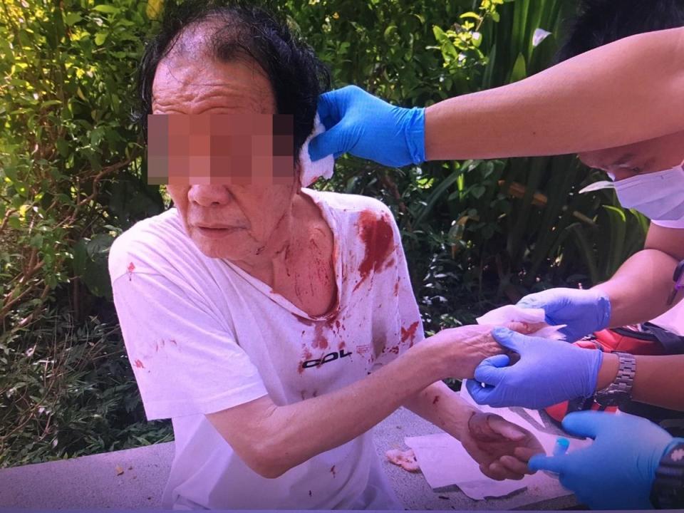 遭攤商老闆砍傷左耳的72歲張姓民眾。（警方提供）