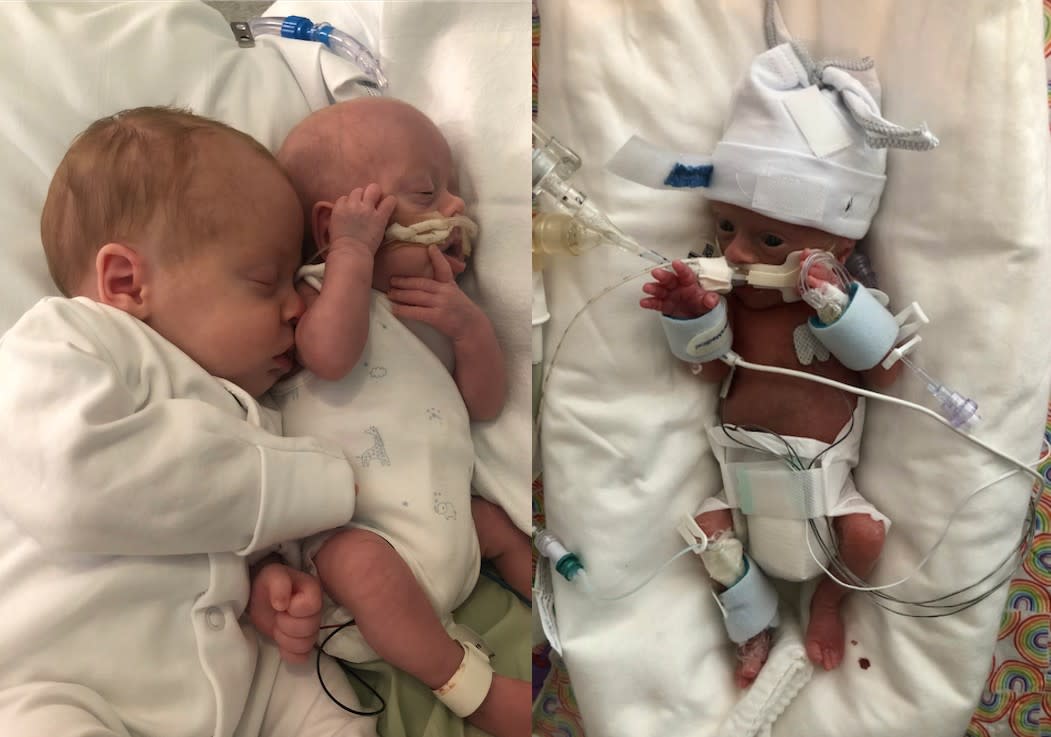 The parents of a premature baby believe cuddles from his twin, Otis (far left) is helping baby Chester (right) to survive. (Caters)