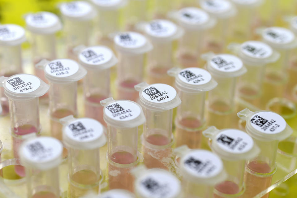In this Thursday, Feb. 6, 2020, photo, tubes of biomaterial samples are placed in the pop-up Huoyan Laboratory specialized in the nucleic acid test on 2019-nCoV in Wuhan in central China's Hubei province. The coronavirus continues to spread as of Friday, Feb. 7, 2020, China reported more than 31,000 cases. (Chinatopix via AP)