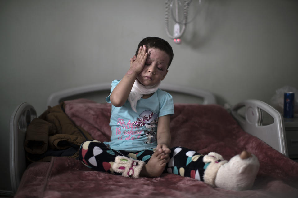 Hawra, de cuatro años y que sufrió quemaduras graves en el ataque aéreo en el oeste de Mosul, sentada en su cama en un hospital en Erbil, Irak, el sábado 8 de abril de 2017. (AP Foto/Felipe Dana)