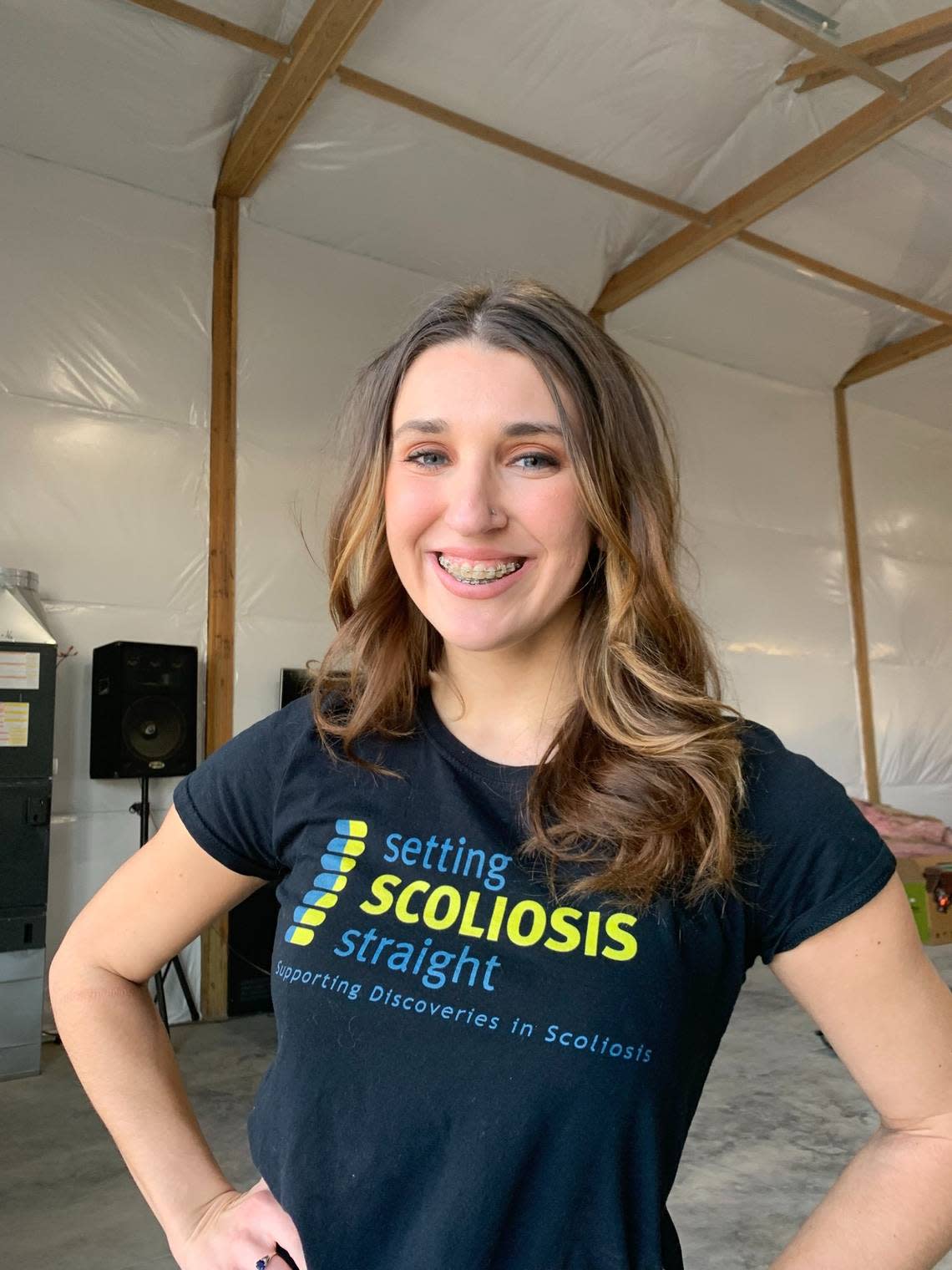 Miss Tri-Cities winner Noël Anderson promotes Setting Scoliosis Straight because of her experience with scoliosis.