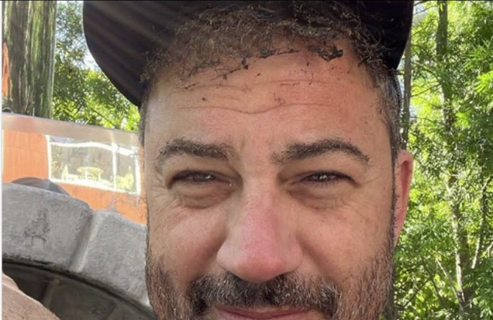 Jimmy Kimmel's burnt hair and eyebrows (c) Instagram credit:Bang Showbiz