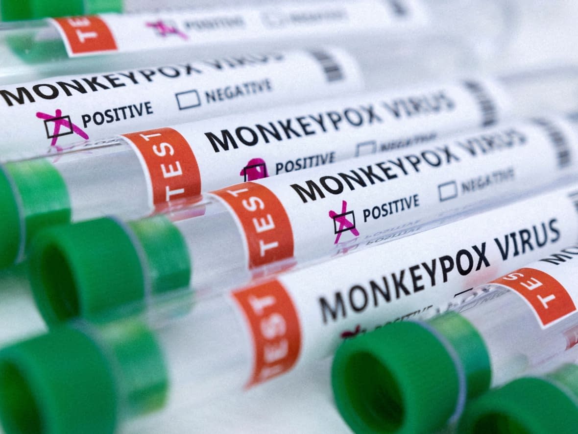 Scientists pushed to have monkeypox and its strains renamed as they say the former names are stigmatizing and inaccurate in reflecting the nature of the current spread of the virus. (Dado Ruvic/Reuters - image credit)