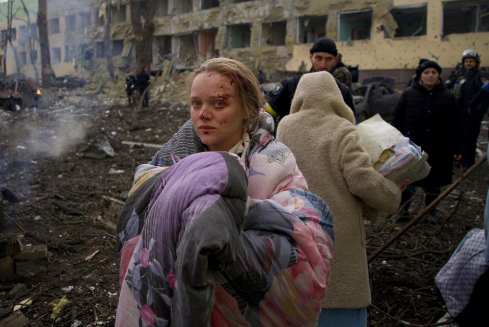 FILE - Mariana Vishegirskaya stands outside a maternity hospital that was damaged by shelling in Mariupol, Ukraine, Wednesday, March 9, 2022. (AP)