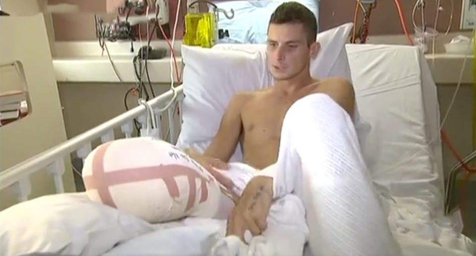 Oliver Doussett, from Sydney’s Northern Beaches, had his leg amputated after he was crushed be a cement truck in Bali. Source: 7 News